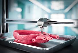 3D bioprinted organs